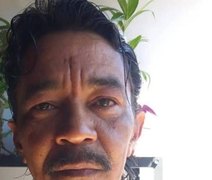 Morre sobrevivente do acidente com césio-137 em Goiás após décadas
