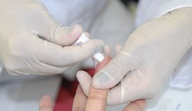 Homens são 60% dos portadores de HIV em Alagoas