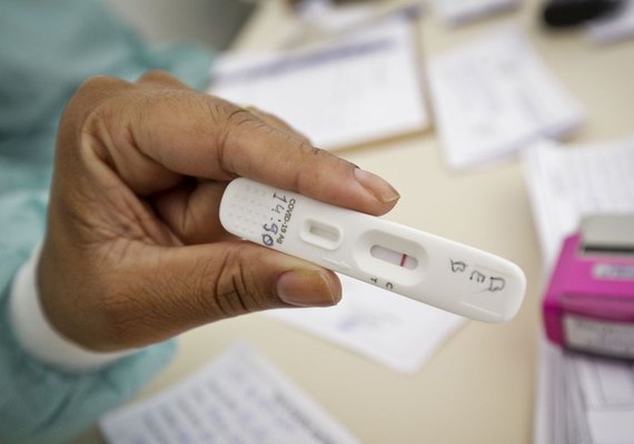 Anvisa aprova uso e comercialização de autoteste para Covid-19