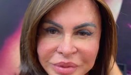 Gretchen registra processo de novo visual enquanto enfrenta alopécia