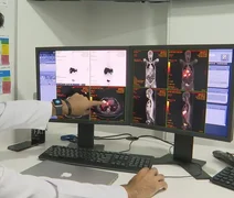 Câncer de próstata tem novo tratamento com radioterapia reduzida