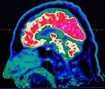 Altas temperaturas e calor têm afetado os nossos cérebros, afirmam especialistas