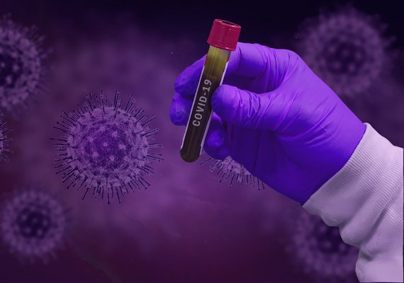 Alagoas têm seis mortes e 195 novos casos de Covid-19