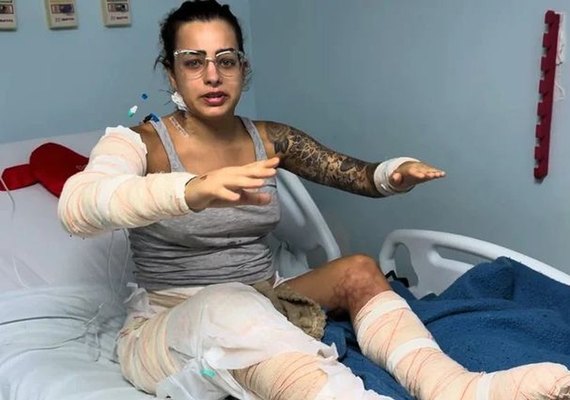 “Não morri porque ele me salvou”, diz mulher após incêndio em kitnet em Maceió