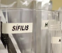 SUS passa a adotar antibiótico para prevenir sífilis e clamídia