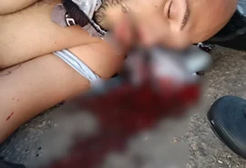 Ciclista é atropelado por caminhão na AL-220, e permanece internado