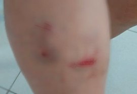 Pai chama a polícia depois de ser mordido pelo próprio filho na Chã do Pilar