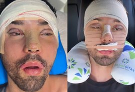 Rico Melquíades faz cirurgias no rosto e desabafa: 'Não aguentava mais ser chamado de feio'