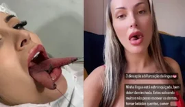 Andressa Urach revela quanto pagou para realizar o procedimento de 'língua de cobra'