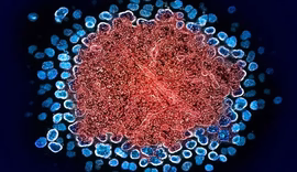 Homem tem remissão do HIV após transplante de medula óssea do irmão