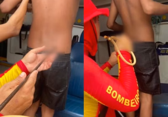 Adolescente é atingido por arpão durante pesca subaquática na Praia do Francês