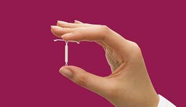 DIU: saiba mais informações sobre o método contraceptivo