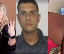 MP denuncia empresária e PM por tortura contra doméstica grávida