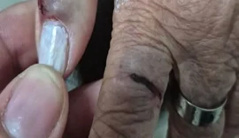 MP denuncia médica por agredir tia idosa com ajuda da filha em Arapiraca