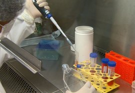 Lacen já realizou mais de 1.500 exames de detecção do novo coronavírus
