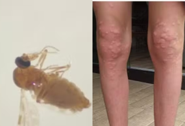 Conheça o mosquito que fez moradores em SC se 'trancarem' em casa