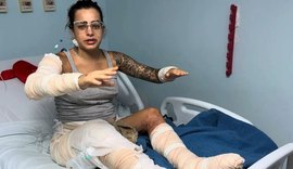 “Não morri porque ele me salvou”, diz mulher após incêndio em kitnet em Maceió