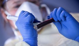 Alagoas confirma mais 263 casos do novo Coronavírus
