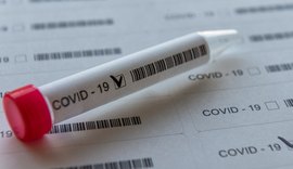 Jovem puérpera de 28 anos é uma das duas vítimas do Covid-19 nesta terça (21)