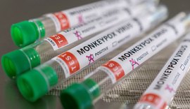 Anvisa recebe pedido de registro para teste de varíola dos macacos