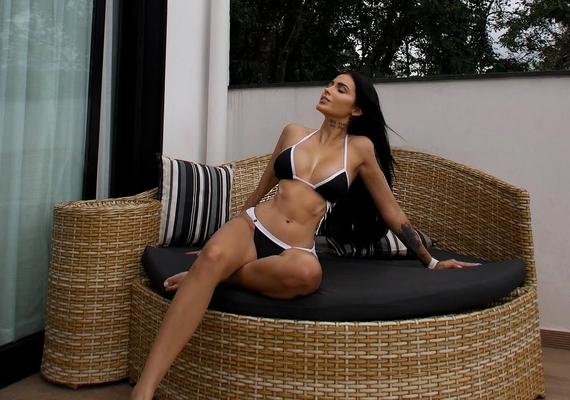 Fernanda Campos faz harmonização de glúteos após críticas na web; confira