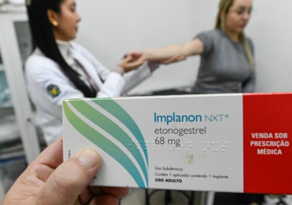 SUS qualifica profissionais para ampliar oferta de implantes hormonais