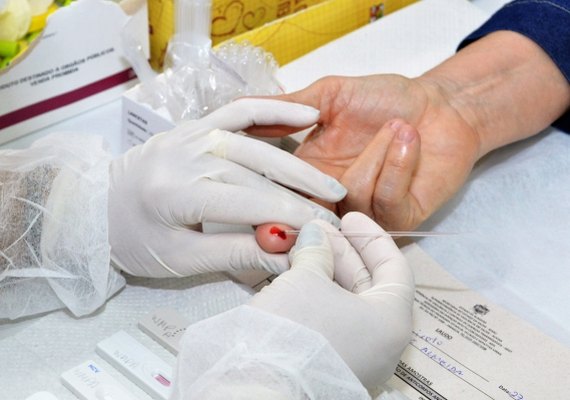 Ambulatório da Sesau atende pacientes em estágio inicial do HIV