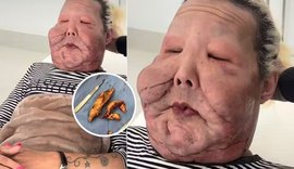 Juju do Pix passa por nova cirurgia para retirada de óleo mineral do rosto