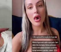 Andressa Urach revela quanto pagou para realizar o procedimento de 'língua de cobra'