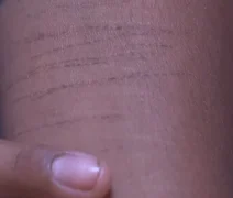 Polícia indica que jovem foi induzida a denunciar falso estupro em Rio Largo