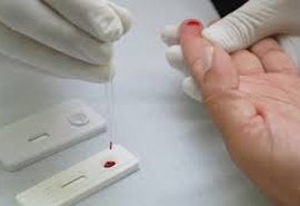 Teste rápido para HIV será promovido pela Sesau neste sábado (28) em AL