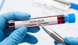 AL registra mais de 10 mil casos de Covid-19 em investigação laboratorial