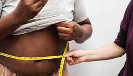 Sesau realiza, nesta terça (16), capacitação sobre obesidade e sobrepeso para os técnicos municipais