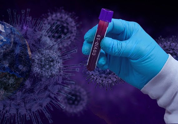 Estado confirma 1.048 casos da Covid-19 em 24 horas