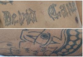 Vítima de agressão procura por familiares em Arapiraca