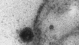 Aplicativo alimentado por tosses pode ajudar na detecção da covid-19