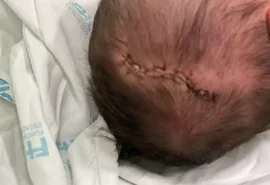 Polícia investiga queda de bebê após parto em recepção de maternidade