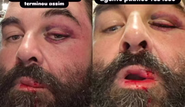 Pai de autista denuncia agressão após reclamar de som alto a fiéis de igreja evangélica