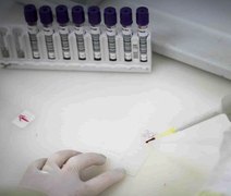 Secretaria de Saúde de SP apura novo caso suspeito de ebola