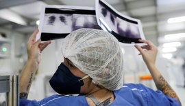 Diagnóstico tardio reduz chances de cura do câncer de pulmão