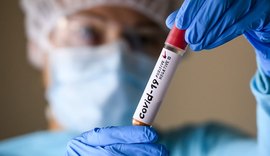 Casos da covid-19 já registrados no Brasil ultrapassam 10 milhões