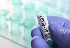 Alagoas confirma mais 729 casos da Covid-19 e 15 óbitos em 24h