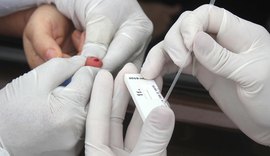 Farmácias de Alagoas devem oferecer testes rápidos de Covid-19 em 15 dias