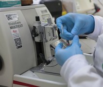Publicada lei que amplia prevenção e controle do câncer no SUS