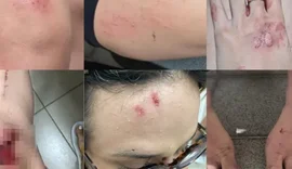 Justiça nega prisão de acusado de agredir influenciadora em Maceió