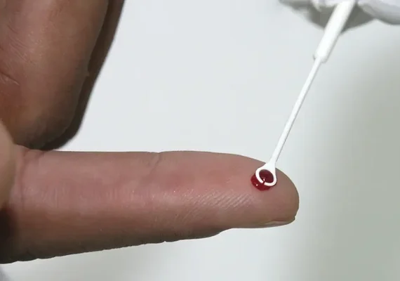 Fiji declara emergência nacional após disparada de casos de HIV