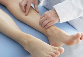 Mutirão realizará 300 atendimentos para doenças vasculares