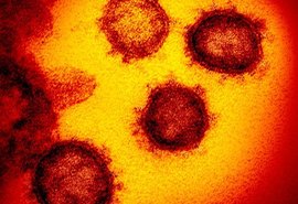 Mais 730 mortes por Covid-19 são registradas no Brasil