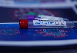 Brasil passa de 2,2 milhões de pessoas infectadas com o novo coronavírus