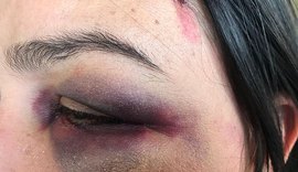 Mulher denuncia agressão por eleitores de Bolsonaro